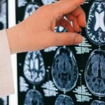 A doctor's hand points to a brain MRI scan on a lightbox, illustrating medical diagnosis.