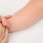 Measles is resurging globally in 2026. Discover how declining vaccination rates and misinformation are triggering outbreaks