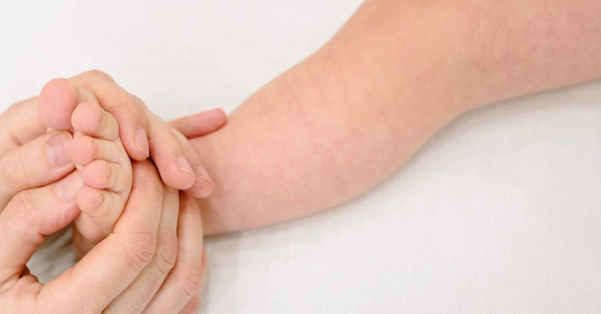 Measles is resurging globally in 2026. Discover how declining vaccination rates and misinformation are triggering outbreaks