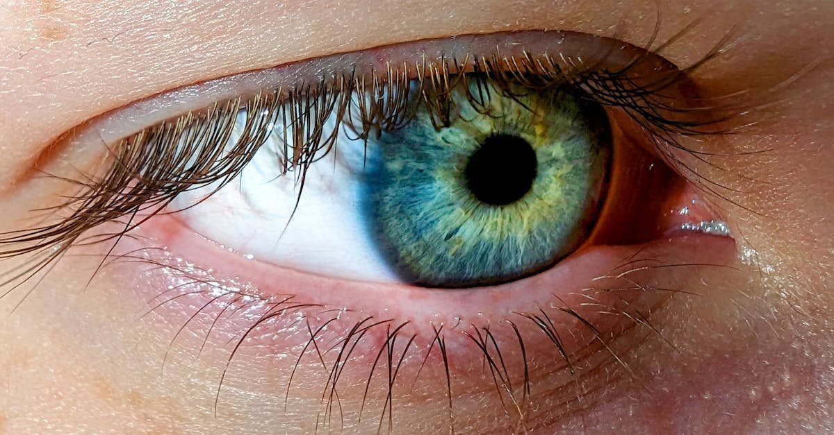 Discover five silent eye warning signs that could signal serious health issues. Learn how to prevent vision loss by identifying blurred vision, floaters, and night blindness early.