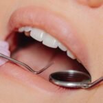 Discover why mouth cancer is rising among non-smoking Indians under 40. Learn about hidden risks like smokeless tobacco, dental trauma, and genetic predispositions today.