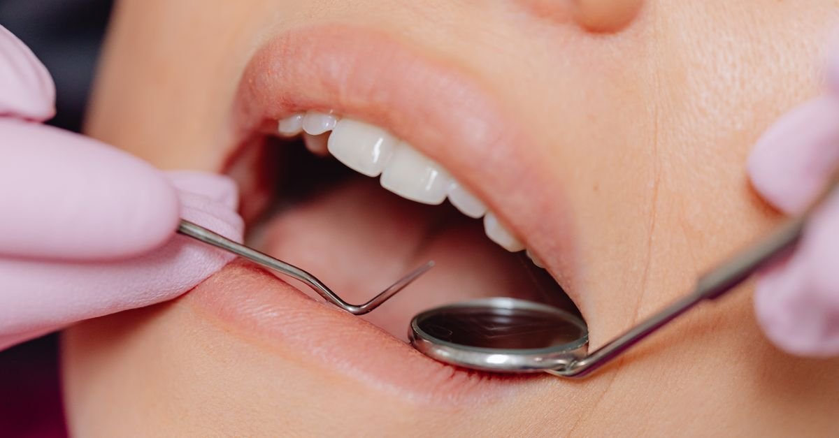 Discover why mouth cancer is rising among non-smoking Indians under 40. Learn about hidden risks like smokeless tobacco, dental trauma, and genetic predispositions today.