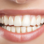Scientists at the University of Nottingham have developed a fluoride-free gel that rebuilds tooth enamel by mimicking natural growth, offering a revolutionary treatment for decay.