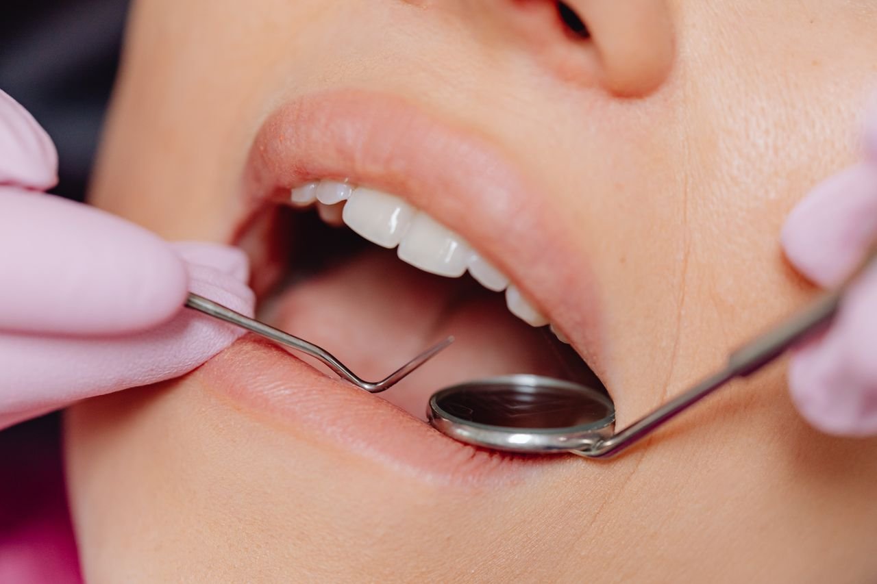 silver-diamine-fluoride-stop-childhood-cavities-without-drilling-trial